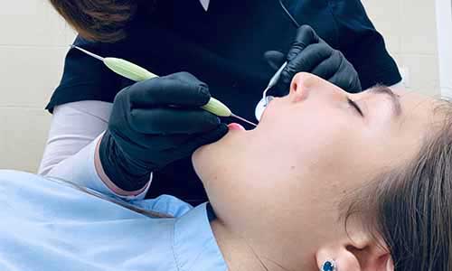 Cosmetic dentistry in Chennai - smile enhancement at Nithya Dental Clinic